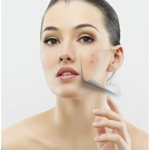 An image of a woman with a scar on her face to promote the homeopathic patch for glutathione and scar tissue from Frequency Apps.