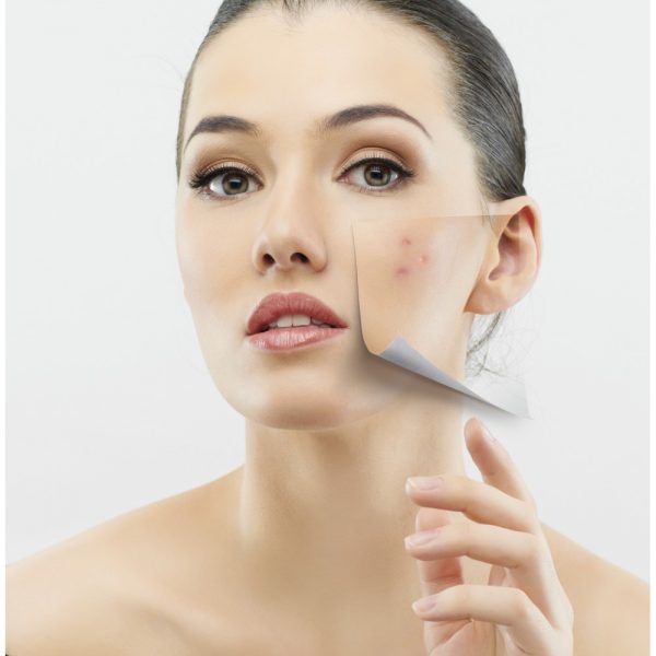 Image of a woman with an overlay showing scar tissue and acne, promoting Glutathione Scar Tissue patches.