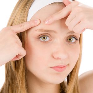 An image of a girl squeezing a pimple on her forehead to promote the acne plus+ homeopathic patches from Frequency Apps