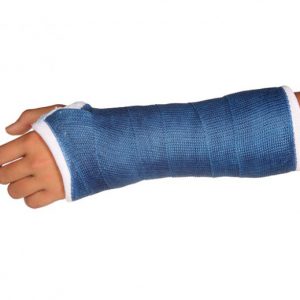 An image of an arm with a blue cast on to promote the homeopathic patches for XL healing from Frequency Apps.