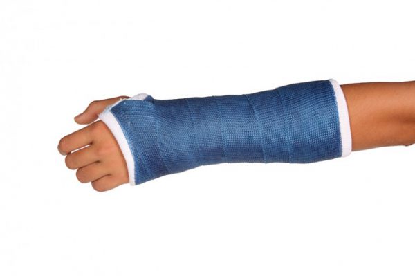 An image of an arm with a blue cast on to promote the homeopathic patches for XL healing from Frequency Apps.