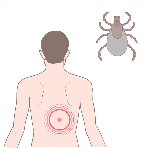 An image of a man with a target on his back and a tick in the corner to promote the Lyme immune booster medicated patches from Frequency Apps.