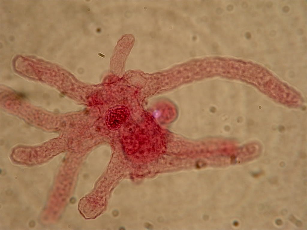 amoeba under microscope labeled
