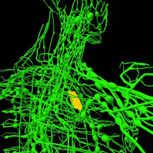 An image of a neon green skeleton with the lymphatic system highlighted yellow to promote the medicated patches for lymphatic drainage from Frequency Apps.